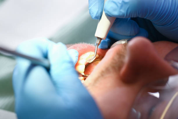 Best Emergency Tooth Extraction  in Luckey, OH