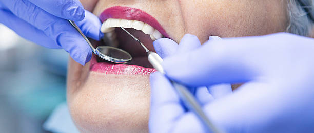 Best Broken Tooth Emergency  in Luckey, OH